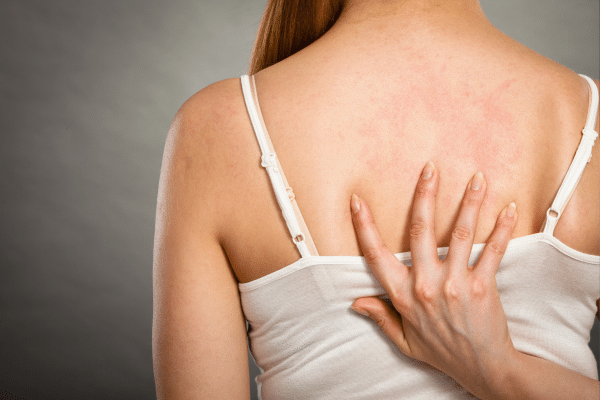 Most Common Signs Of Chronic Inflammation