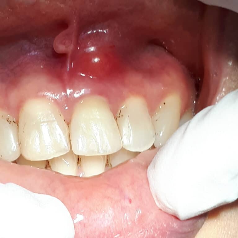 The Consequences Of Neglecting Dental Health